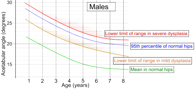 Eine Grafik, die die Korrelation zwischen männlichen und weiblichen Altersgruppen zeigt, wobei die untere Grenze des Bereichs in schwerer Dysplasie durch unterschiedliche Farben angezeigt wird und von begleitendem Text begleitet wird.